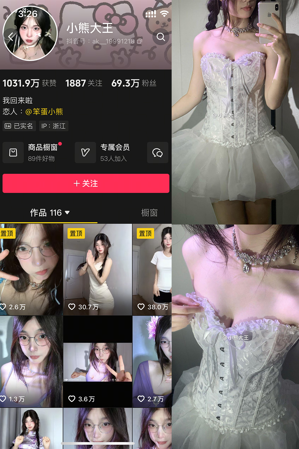 抖音 小熊大王 微密圈 001期 【32P】-私募小圈